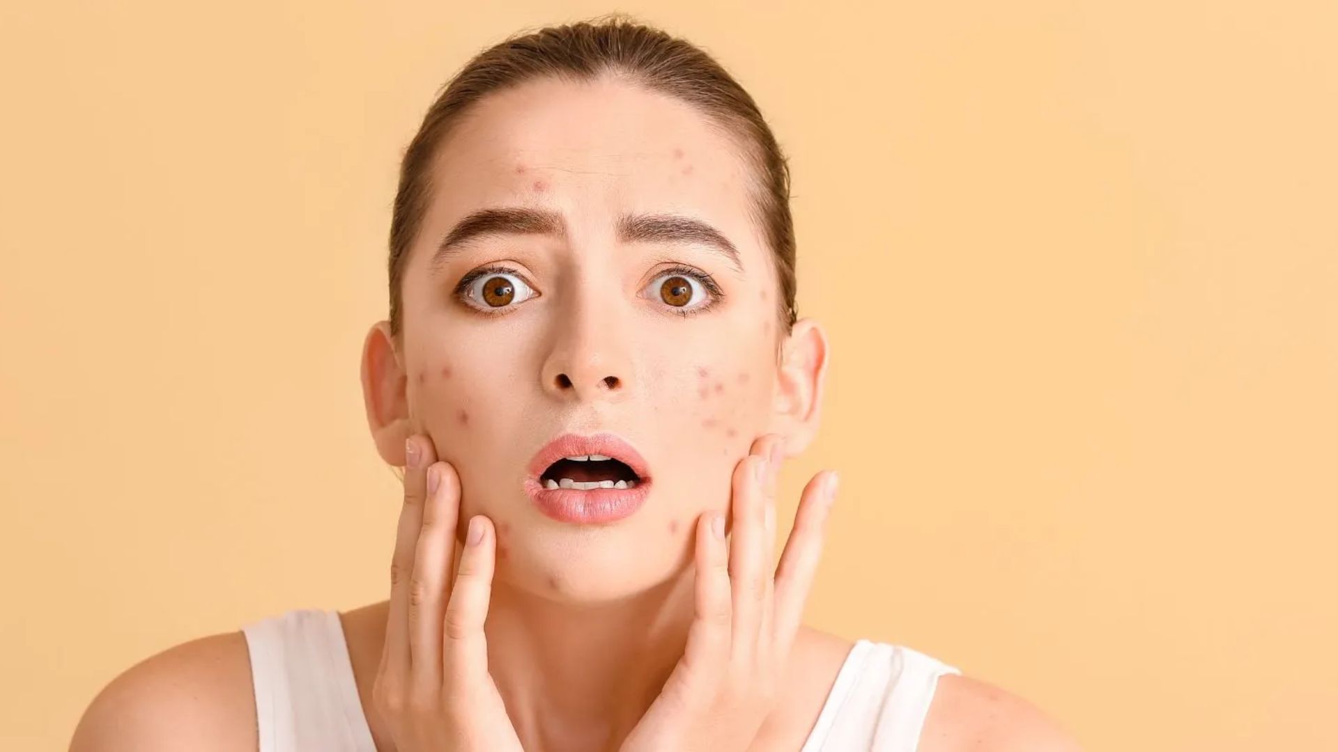 কন্ট্যাক্ট ডার্মাটাইটিস কী এবং কেন হয়? প্রতিরোধের উপায়!