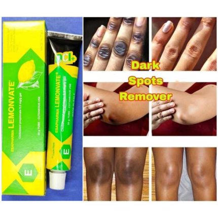 Esapharma Lemonvate Cream 30gm