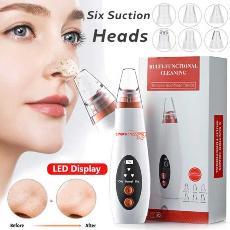 Rechargeable Electric Blackhead Removal Tool Rechargeable Electric Blackhead Removal Tool - Image 1